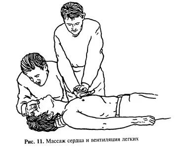 Массаж сердца картинки