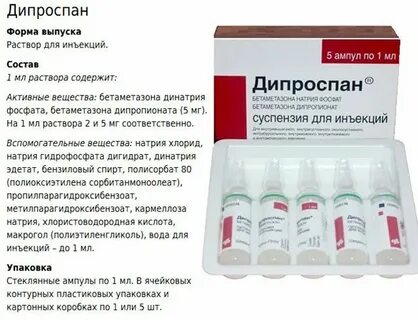 Блокады дипроспан как часто делают