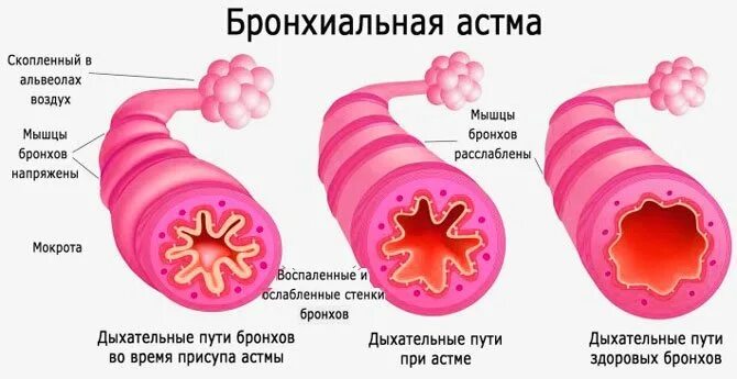 Не хватает воздуха при дыхании хочется зевать. Тяжело дышать не хватает воздуха. Нех вотает воздуха при дыхании. Ребёнку тяжело дышать не хватает воздуха причины. Трудно вдыхать воздух причины.