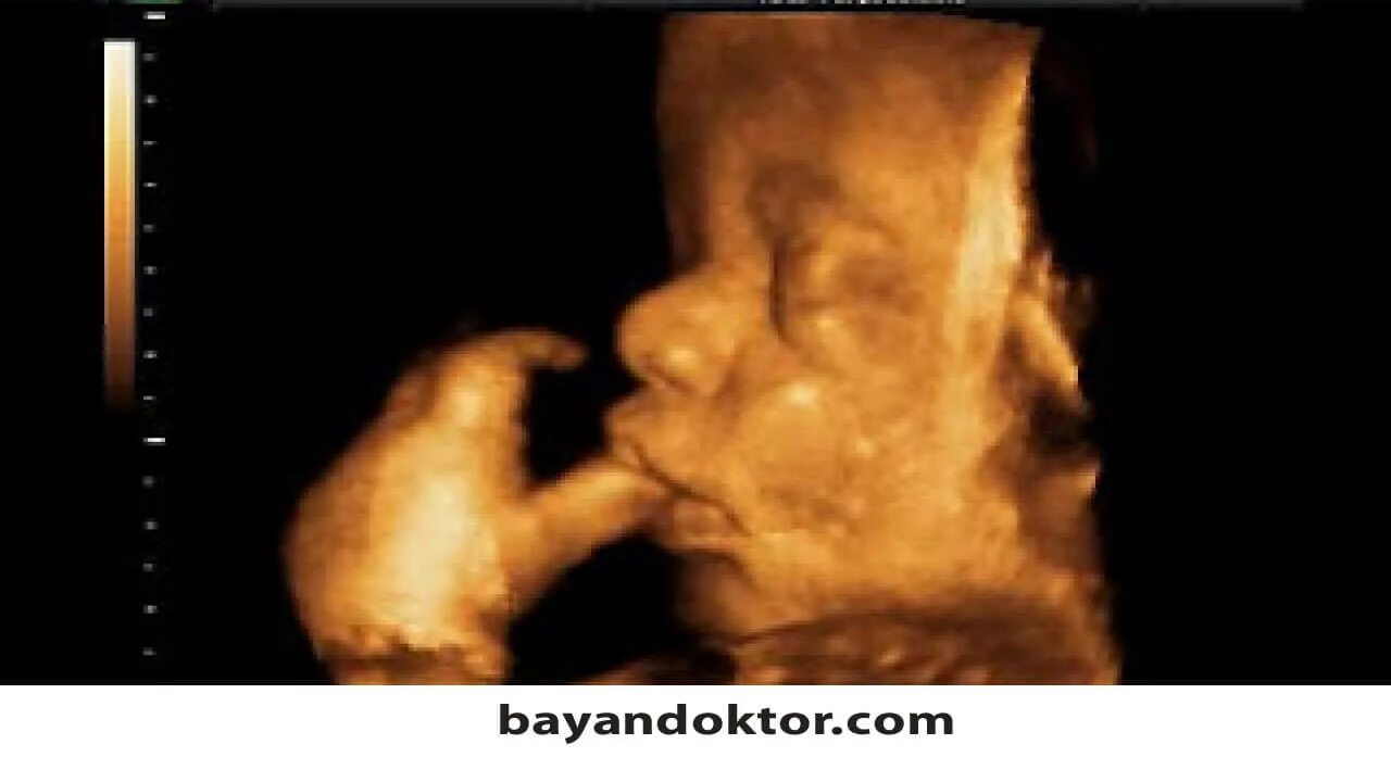 3д узи на 32 неделе беременности. 3д узи на 24 неделе беременности. снимок лица ребенка в утробе матери. 30 недель беременности 4 д узи. лица детей в утробе.