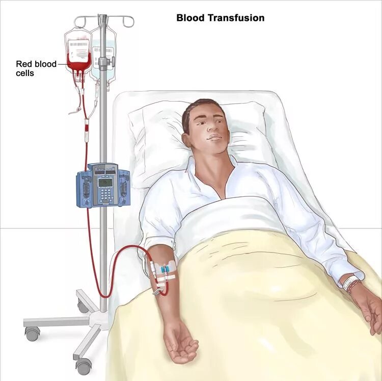 Переливание крови спасло жизнь. Процедура переливания крови. Переливание крови больному. Гемотрансфузия.