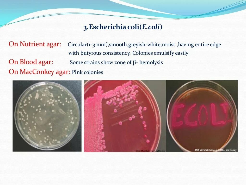 Escherichia coli гемолитические антибиотики. Escherichia coli непатогенные. Escherichia coli эшерихии. Эшерихия микробиология. Escherichia coli что это у мужчин