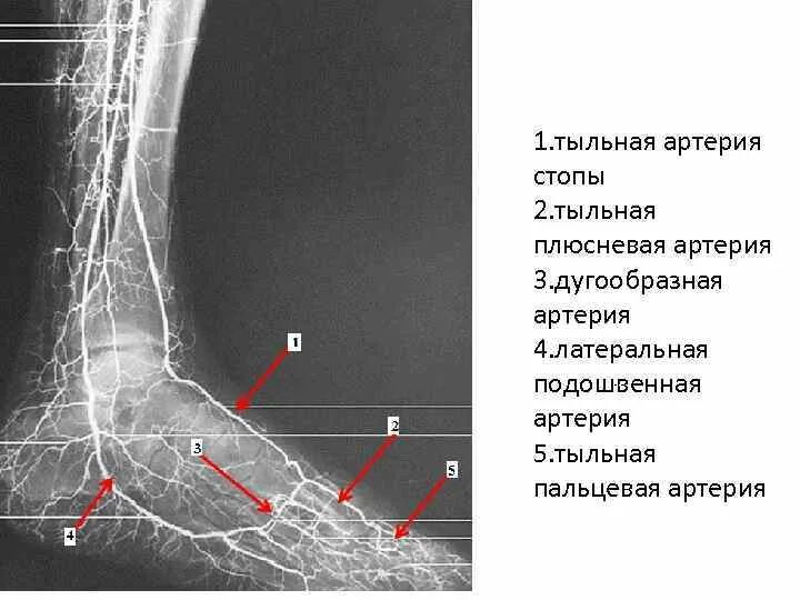 Тыльные плюсневые артерии. Тыльная плюсневая артерия стопы. Основные артерии стопы