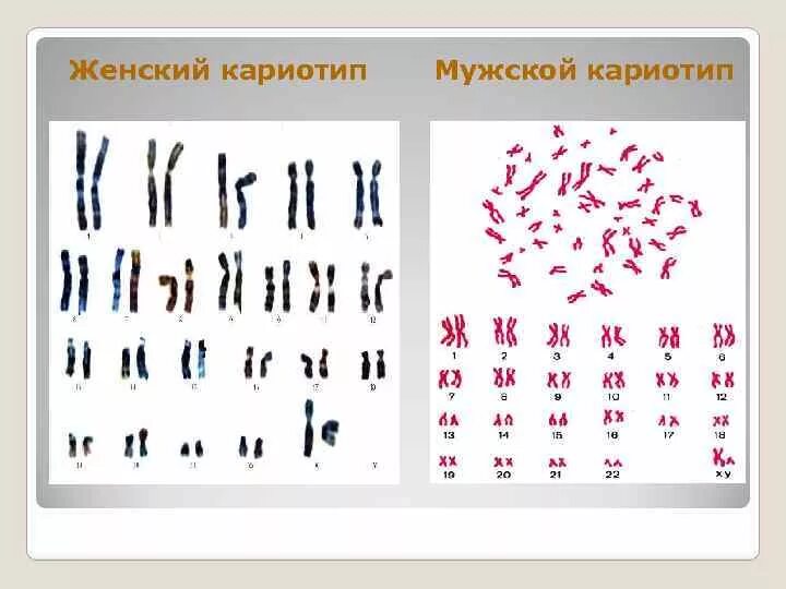 Кариотипирование супругов цена. Кариотипирование генетика. Набор хромосом, геном, кариотип.. Кариотипирование хромосом. Кариотип человека в норме.