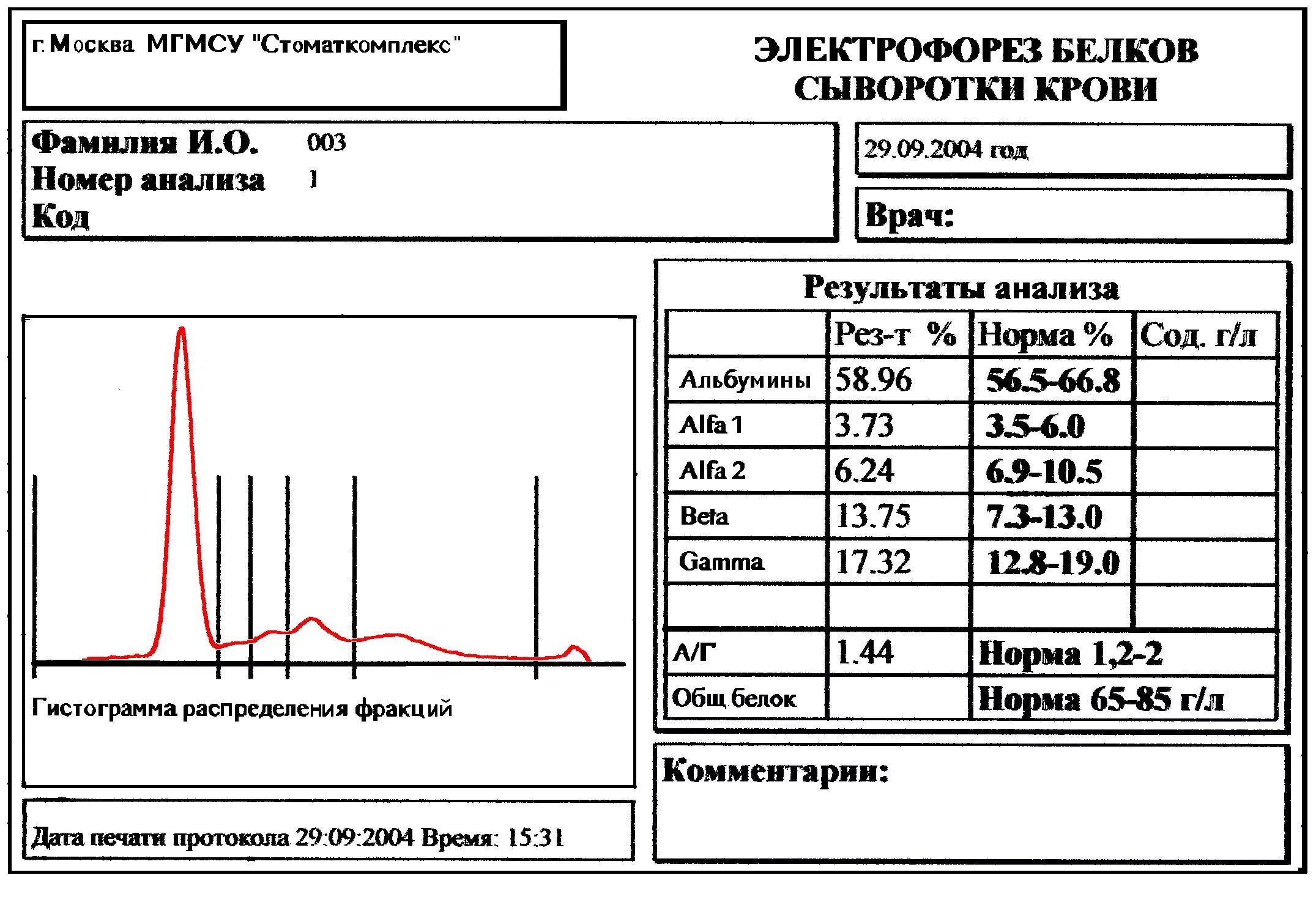 Анализ номер 9. Электрофорез белковых фракций крови расшифровка норма. Электрофорез белков нормы фракций. Электрофорез белков сыворотки крови норма. Электрофорез белков сыворотки крови расшифровка.