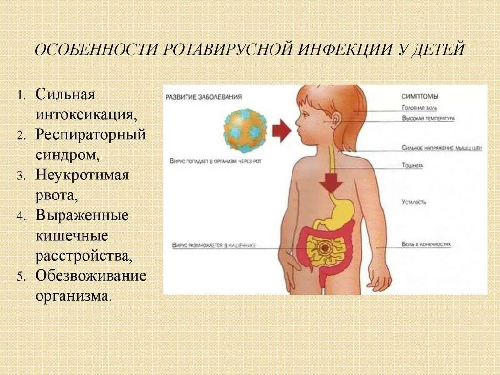 Ротавирусная инфекция дети 3 года. Ротавирусная инфекция дети 3 года