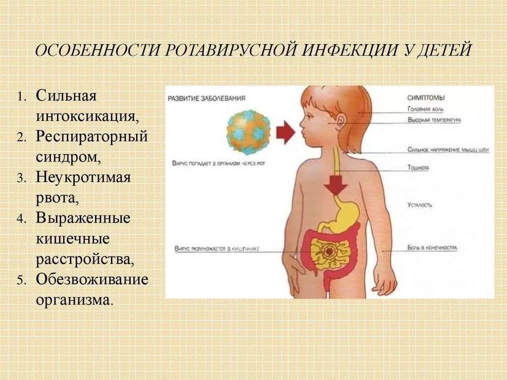 Инфекционные заболевания рвота. Ротавирусные инфекции у детей. Симтомы короновируса у де. Ротавирусная инфекция. Ротавирусная инфекция у детей.