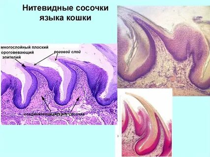 Нитевидные сосочки