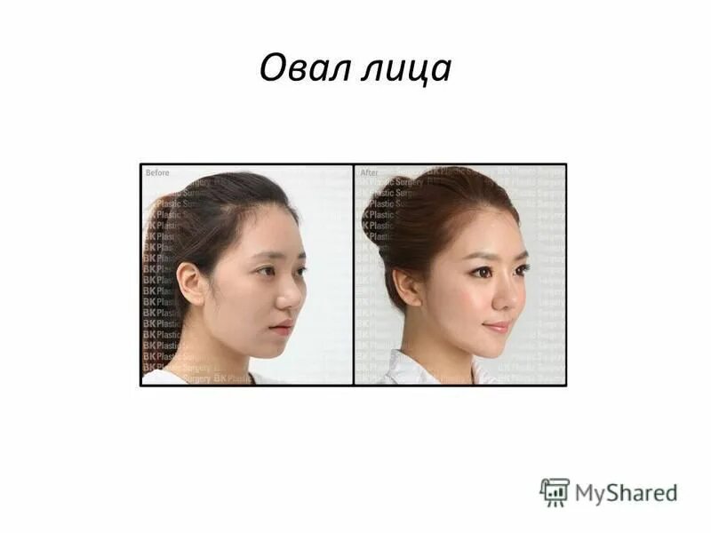стандарты красоты в южной корее. тест на корейские стандарты красоты сколько. стандарты красоты в корее.