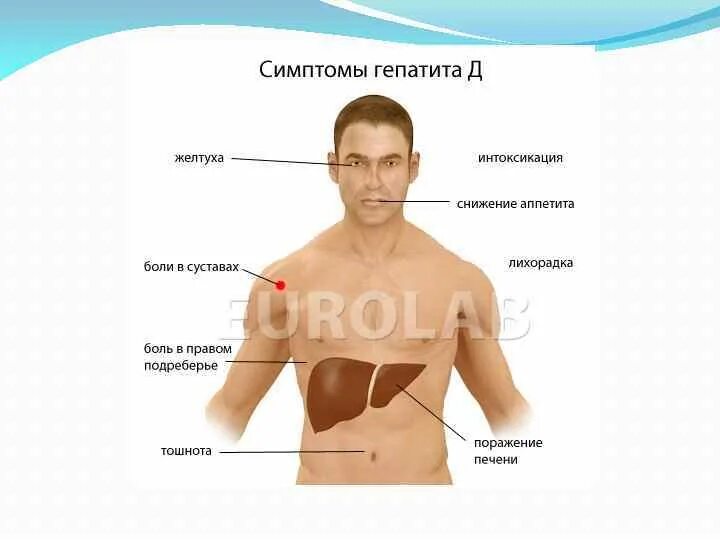 животик болит. левый бок живота. живот аппендицит болит. болит живот симптомы у женщин. живот бонни.
