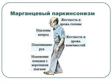 Паркинсонизм