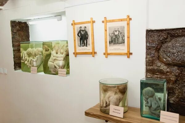 кунсткамера гродно фото. кунсткамера гродно. анатомическая экспозиция «гродненская кунсткамера». кунсткамера в гродно с детьми. музей гродно кунсткамера.