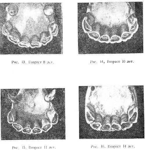Определить возраст книги. Возраст лошади по зубам. Зубы лошадей по возрасту. Определение возраста лошади по зубам. Как определить Возраст лошади.
