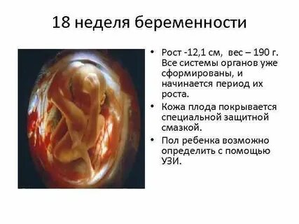 Конец 18 недели