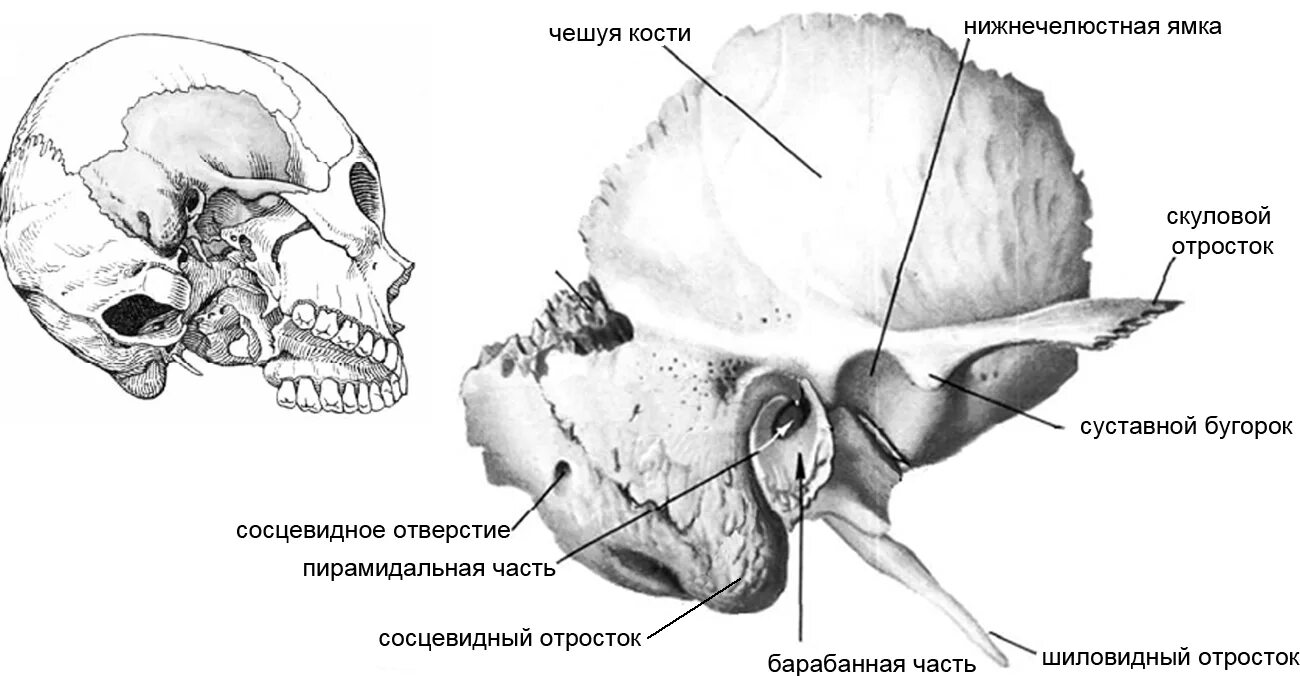 Скуловой отросток височной кости на черепе. Височная кость черепа анатомия. Сосцевидный отросток анатомия. Отросток височной кости антропология. Изменения височной кости