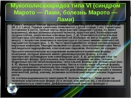 Мукополисахаридоз 2 типа у детей по утвержденным