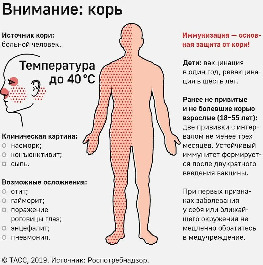 Корь клиническая картина. Корь симптомы у детей и взрослых.