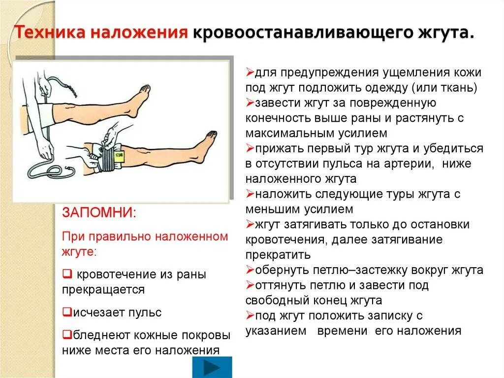 Если при открытом переломе имеется повреждение артерии. Алгоритм действий при остановки кровотечения с помощью жгута. Мобилизация конечности приналожении жгута. Инструкция по наложению жгута. Техника наложения кровоостанавливающего жгута.