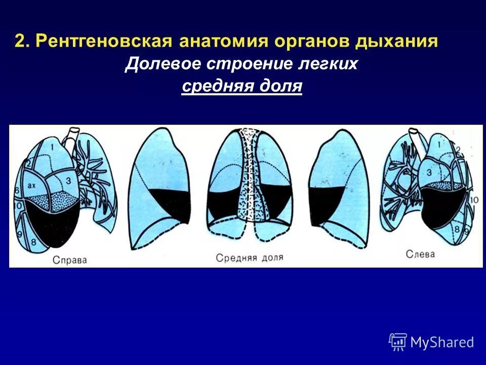 сегменты нижней доли правого легкого. доли легкого справа. доли правого легкого. доли в правом и в левом легком. радиолоджи 24 сегменты легких.
