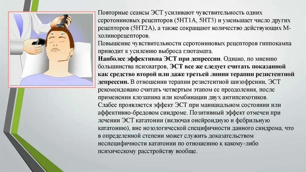 Лечение эст. Эст электросудорожная терапия. методика проведения электросудорожной терапии. электросудорожная терапия шизофрения.