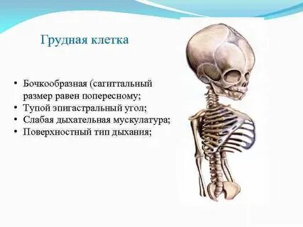 Грудная клетка у детей 3 лет