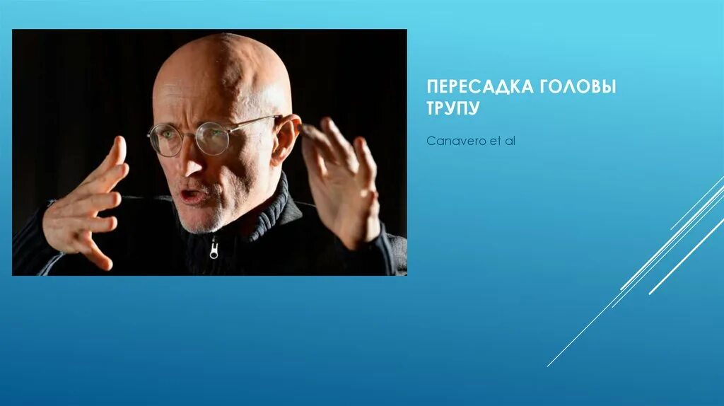 Серджио Канаверо. Голова профессора Канаверо. Трансплантация головы.