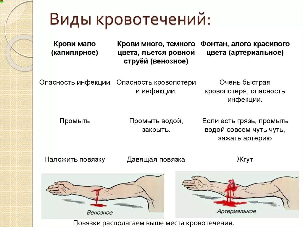 Кровотечения делятся на. Типы кровотечений рисунки. Способы остановки крови при разном виде кровотечения. Таблица вид кровотечения краткая характеристика способы остановки. ОБЖ виды кровотечений венозное артериальное.