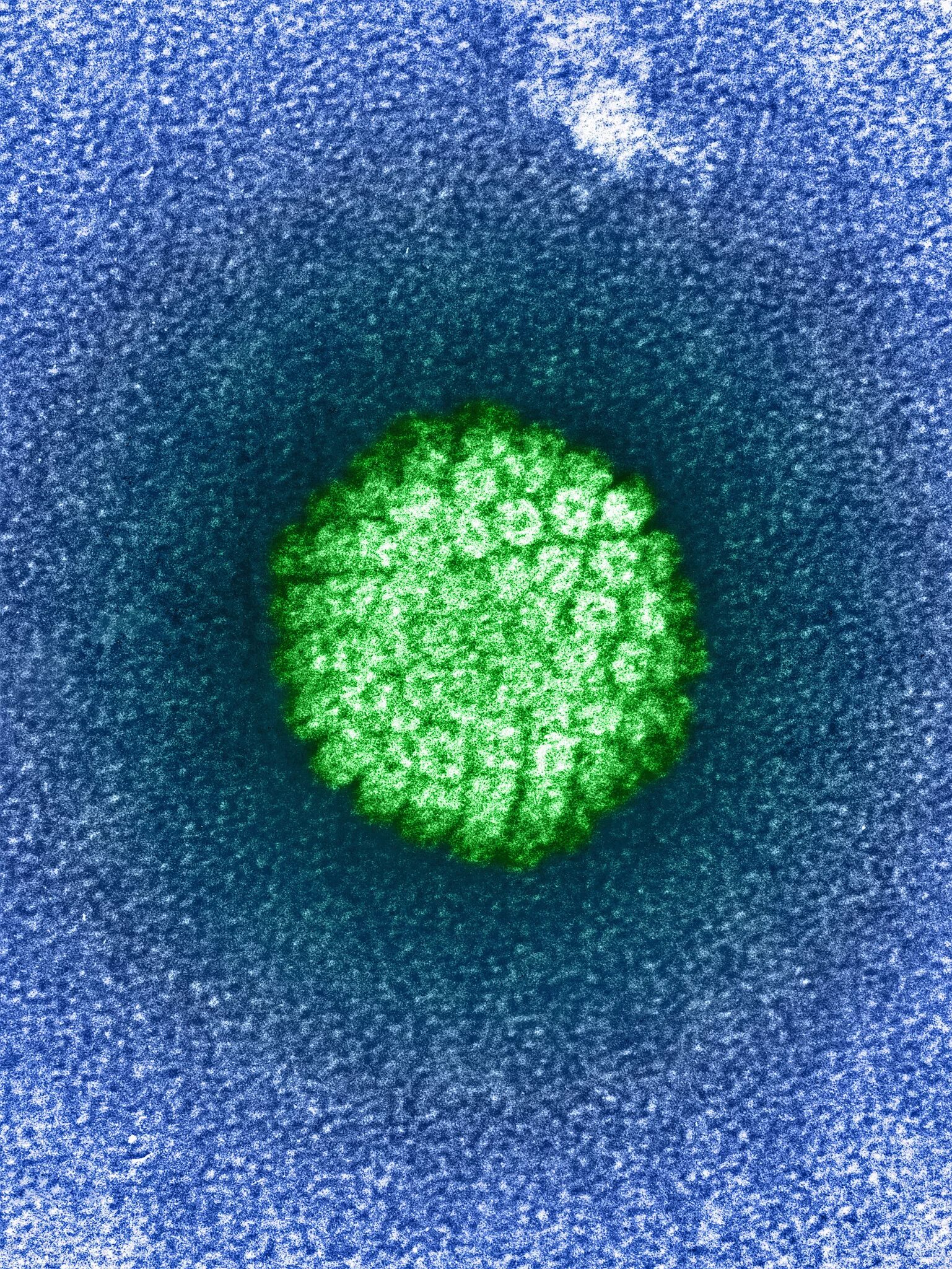 Papilloma virus. Вирус папилломы человека электронная микрофотография. Вирус папилломы под микроскопом. Вирус ВПЧ под микроскопом. Папилломавирус под микроскопом.