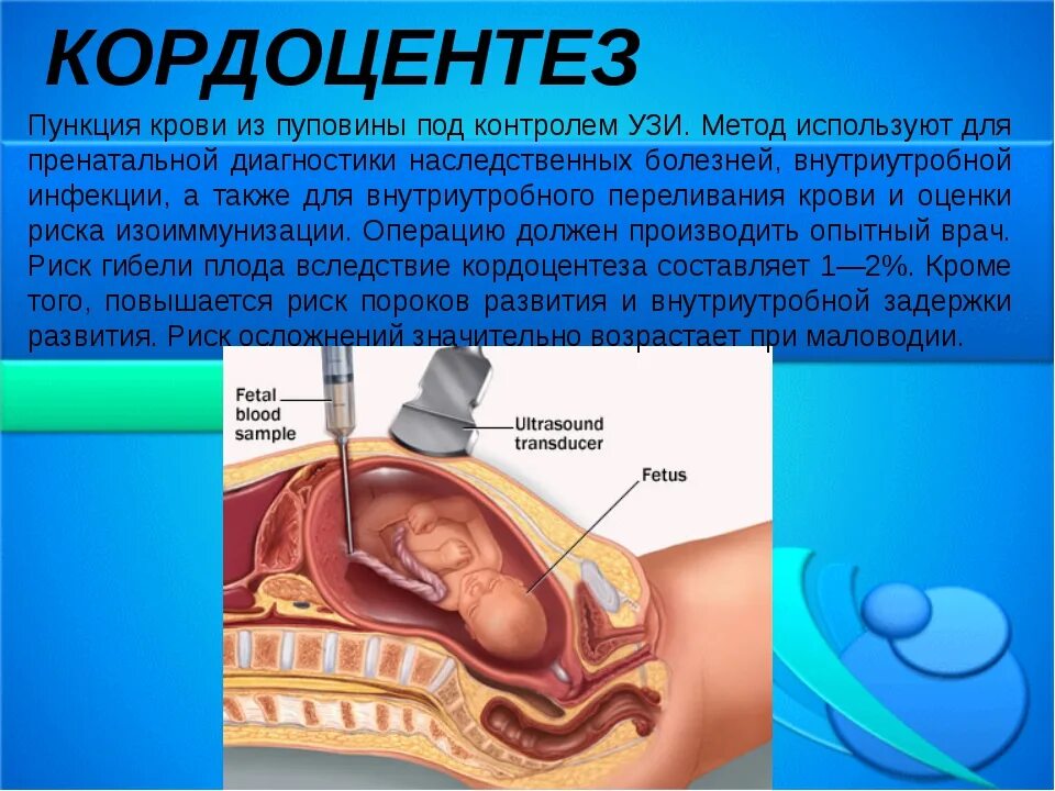 Трансабдоминальный кордоцентез. Исследование пуповинной крови плода. Амниоцентез и кордоцентез. Кордоцентез инвазивная процедура. Осложнения после пункции