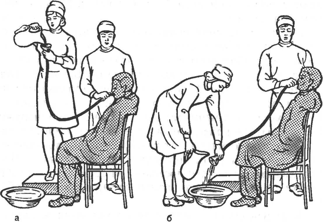 Зондовые манипуляции. Зондовое промывание желудка. Промывание желудка алгоритм. Промывание желудка алгоритм Сестринское. Промывание желудка зондом алгоритм.