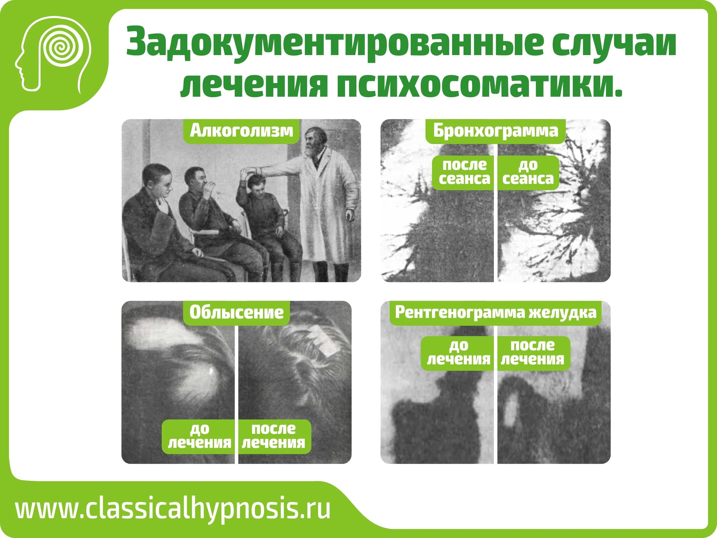 Бронхиальная астма психосоматика. Психосоматика. алкоголизм психосоматика. психосоматические расстройства. психосоматика болезней лечение.
