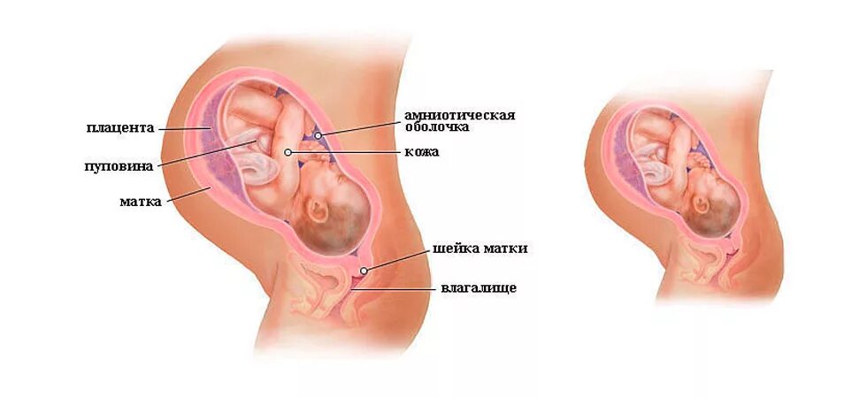 Положение ребенка на 29 неделе беременности. Расположение плода на 20 неделе. Расположение плода на 27 неделе беременности. Положение малыша в животе на 29 неделе беременности.