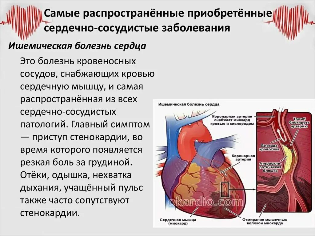 Заболевания сердечной системы. Сердечно-сосудистые заболевания. Болезни сердечно-сосудистой системы. Заболевания сердца системы. Самые распространенные сердечно-сосудистые заболевания.