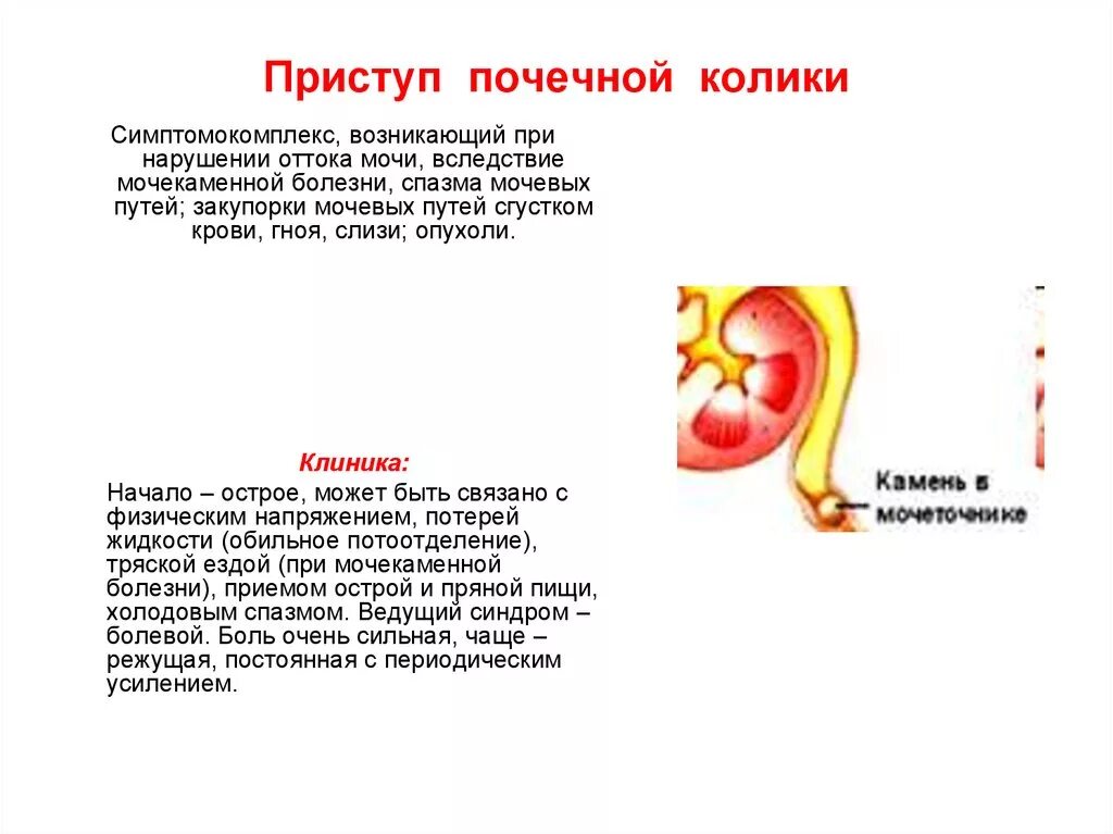 Боль и ноет в почках. Приступ посечной колике. Приступ почечной колики. При приступе почечной колики.