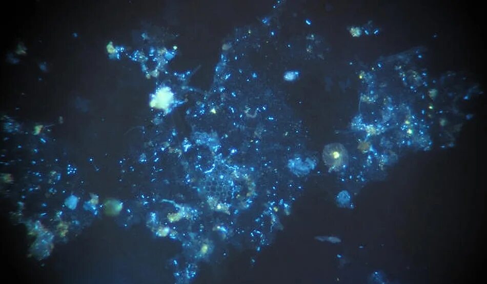 Фитопланктон. Океанические бактерии. Фитопланктон под микроскопом. Фитопланктон картинки.