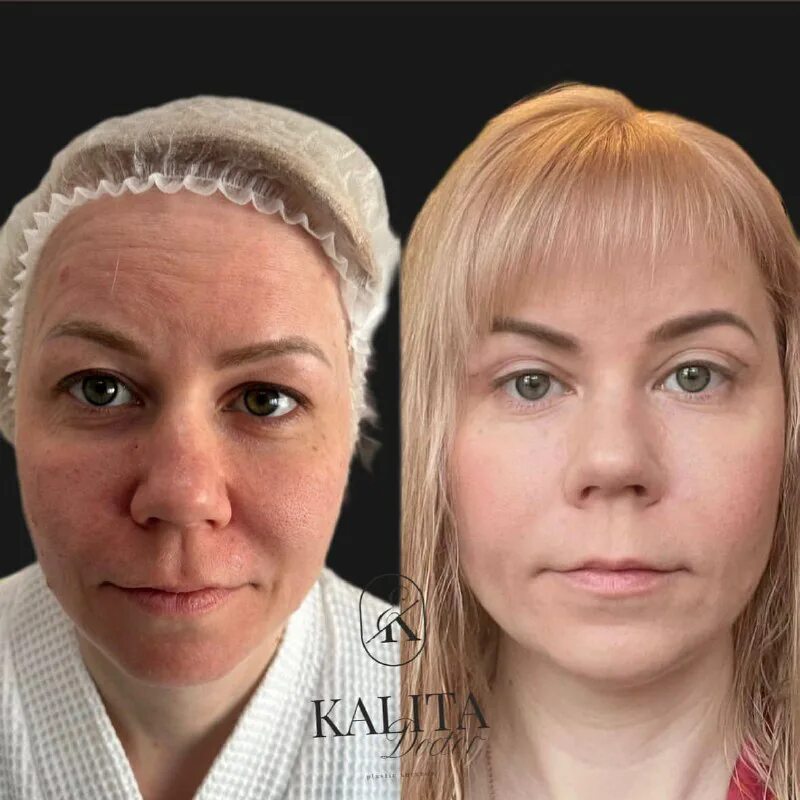 калита екатерина романовна изуродывала. кира кириллова пластический хирург. валерия калита пластический хирург. главный хирург тюменской области. калита пластический хирург.