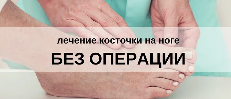 Как лечить косточку на ноге. Фольга для косточки на ноге. Операция на костяшках на ногах. Убираем косточки без операции