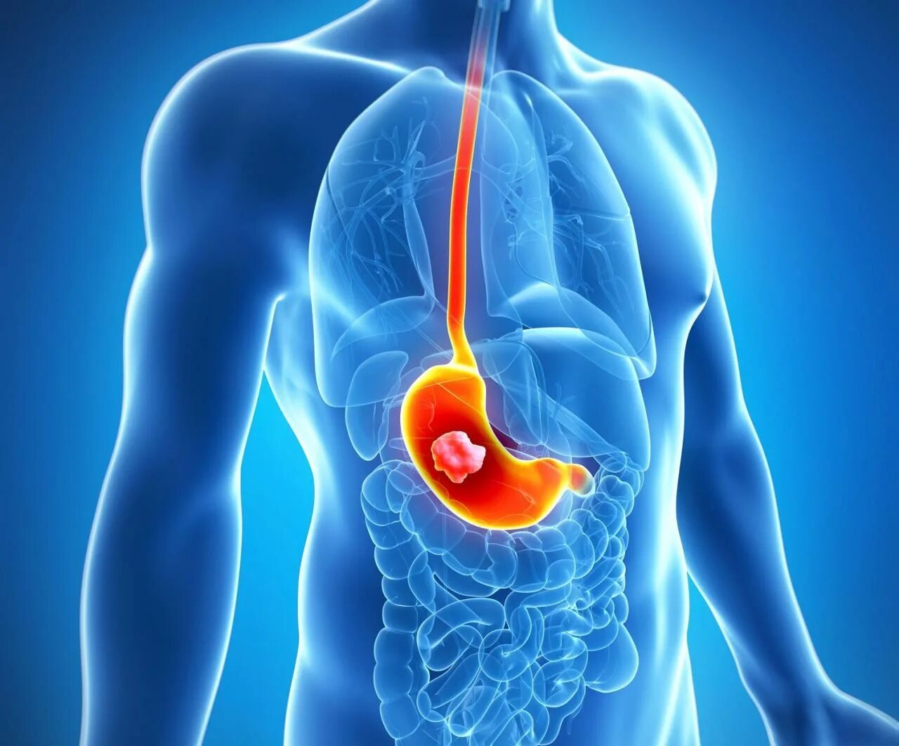 Дискинезии пищеварительного тракта. Жкт это в медицине. Боли в животе. Проблемы с пищеварением. Проблемы с пищеварением.