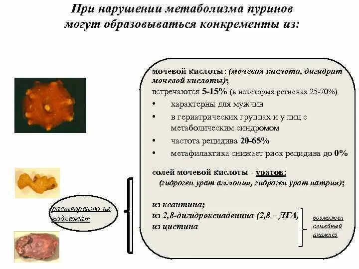 Мочевая кислота в моче у мужчин. Мочевая кислота при подагре показатели. Основные механизмы метаболизма мочевой кислоты. Дигидрат мочевой кислоты. Витамины при мочевой кислоте.