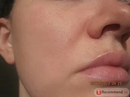 Лавровый лист от прыщей