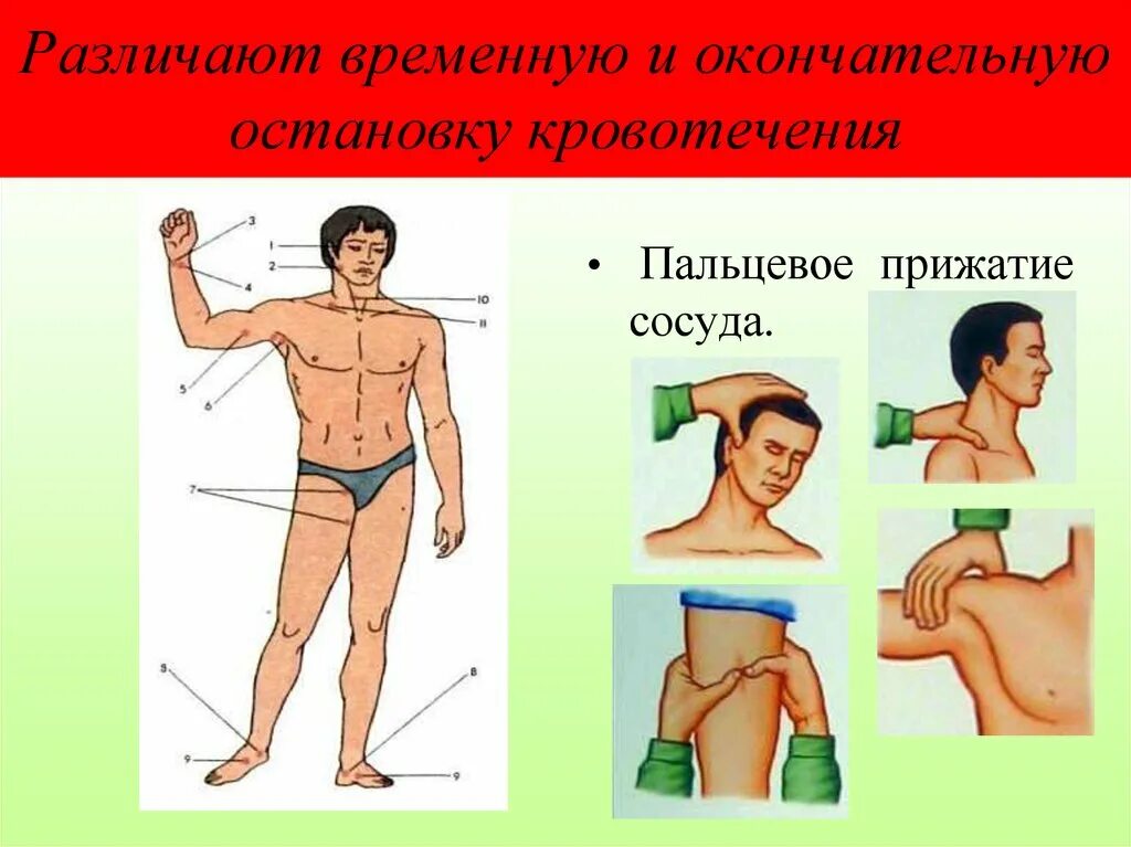 Способы остановки кровотечения пальцевое прижатие артерии. Кровотечения прижатие артерий. Места остановки кровотечения. Остановка кровотечения пальцевым прижатием. Временная остановка кровотечений, пальцевое прижатие артерий.