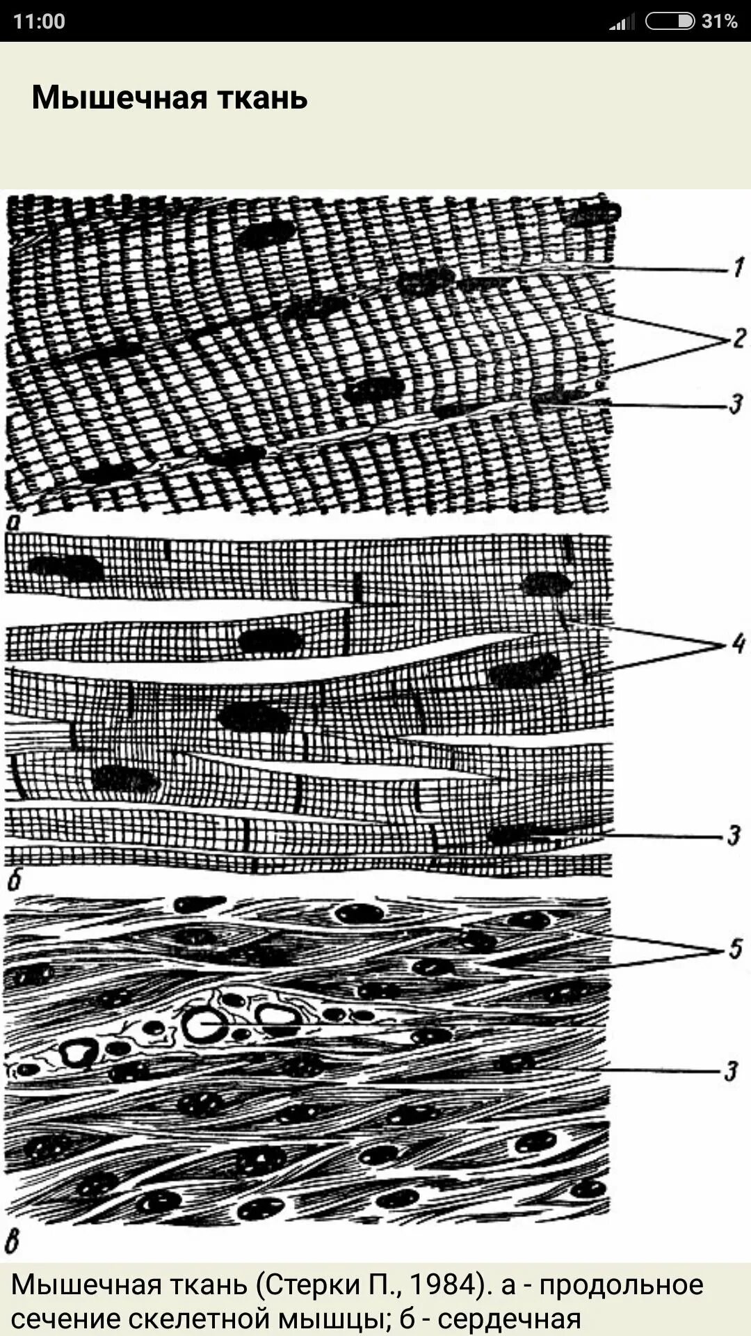 Строение клетки поперечно полосатой мышечной ткани. Поперечно полосатая мышечная ткань гистология. Поперечно исчерченная мышечная ткань гистологи. Поперечно Скелетная мышечная ткань. Исчерченная сердечная мышечная ткань гистология.