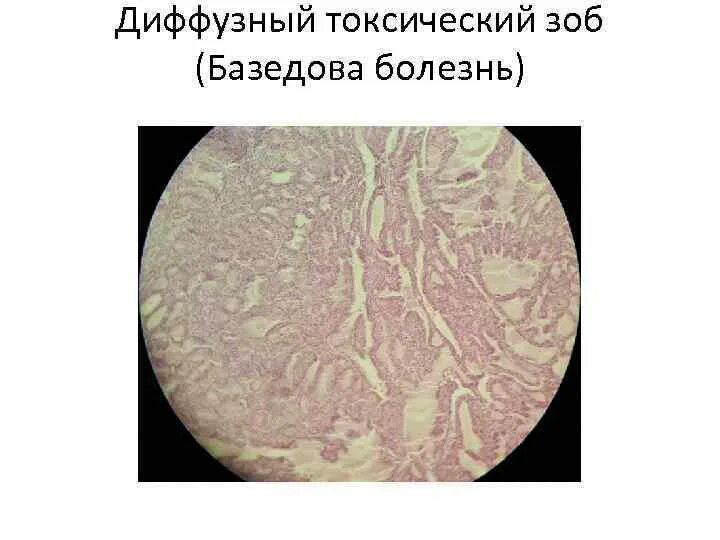 Диффузная область