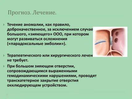 Случае порок