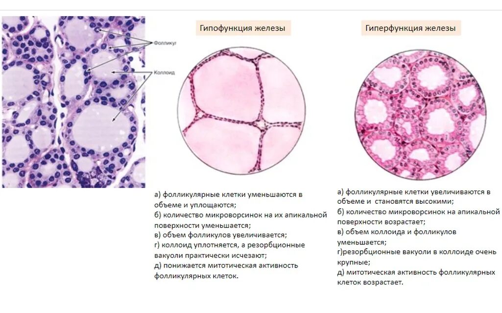 Гиперфункция щитовидной железы гистология. Строение щитовидной железы гистология. Гипофункция и гиперфункция щитовидной железы гистология. Фолликул щитовидной железы гистология гиперфункция.