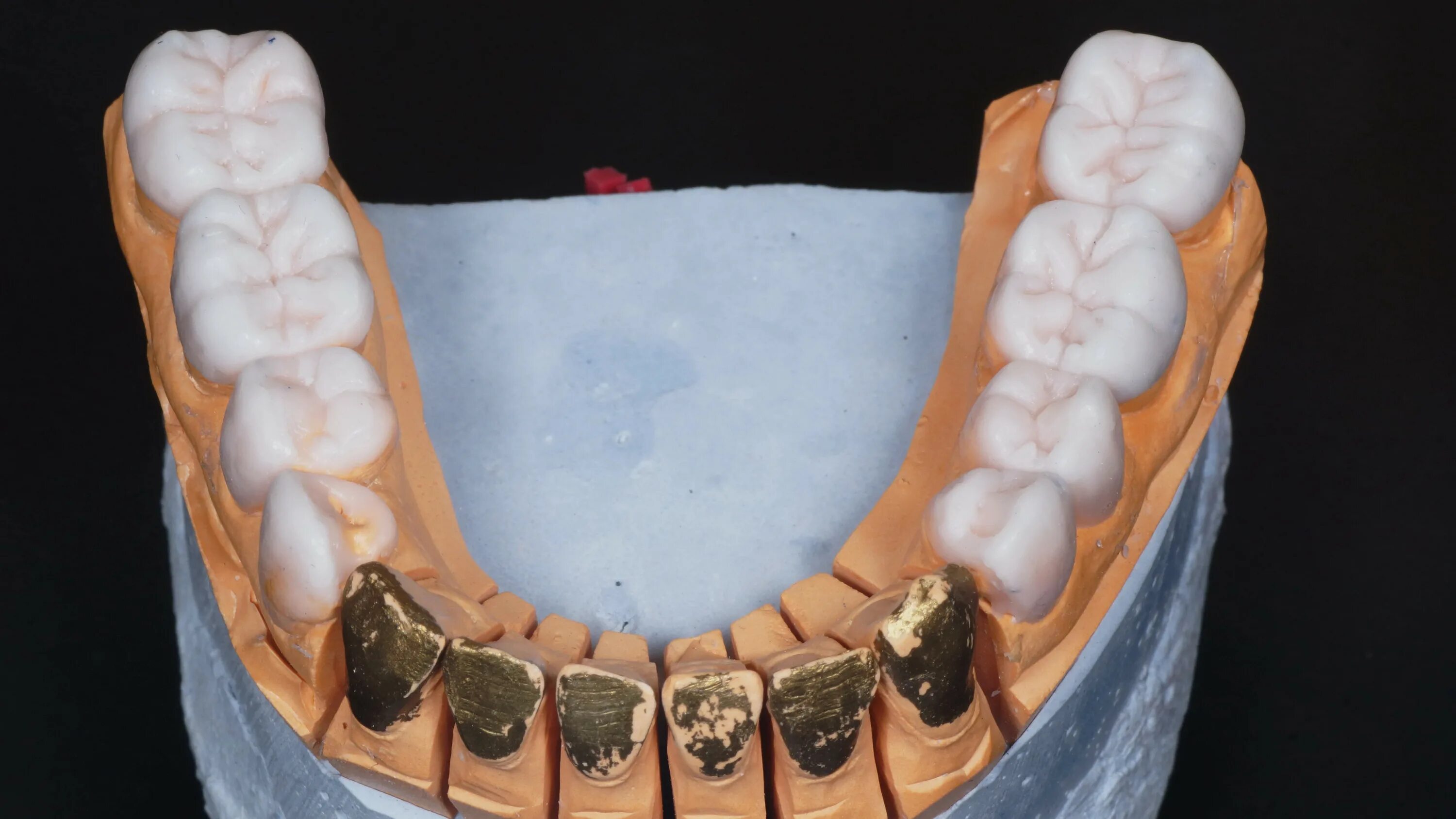 4zl зуботехническая лаборатория. Зубной техник беларусь. Зубной техник меркулов. Стоматология ортопедическая зубной техник. Зубной техник беларусь.