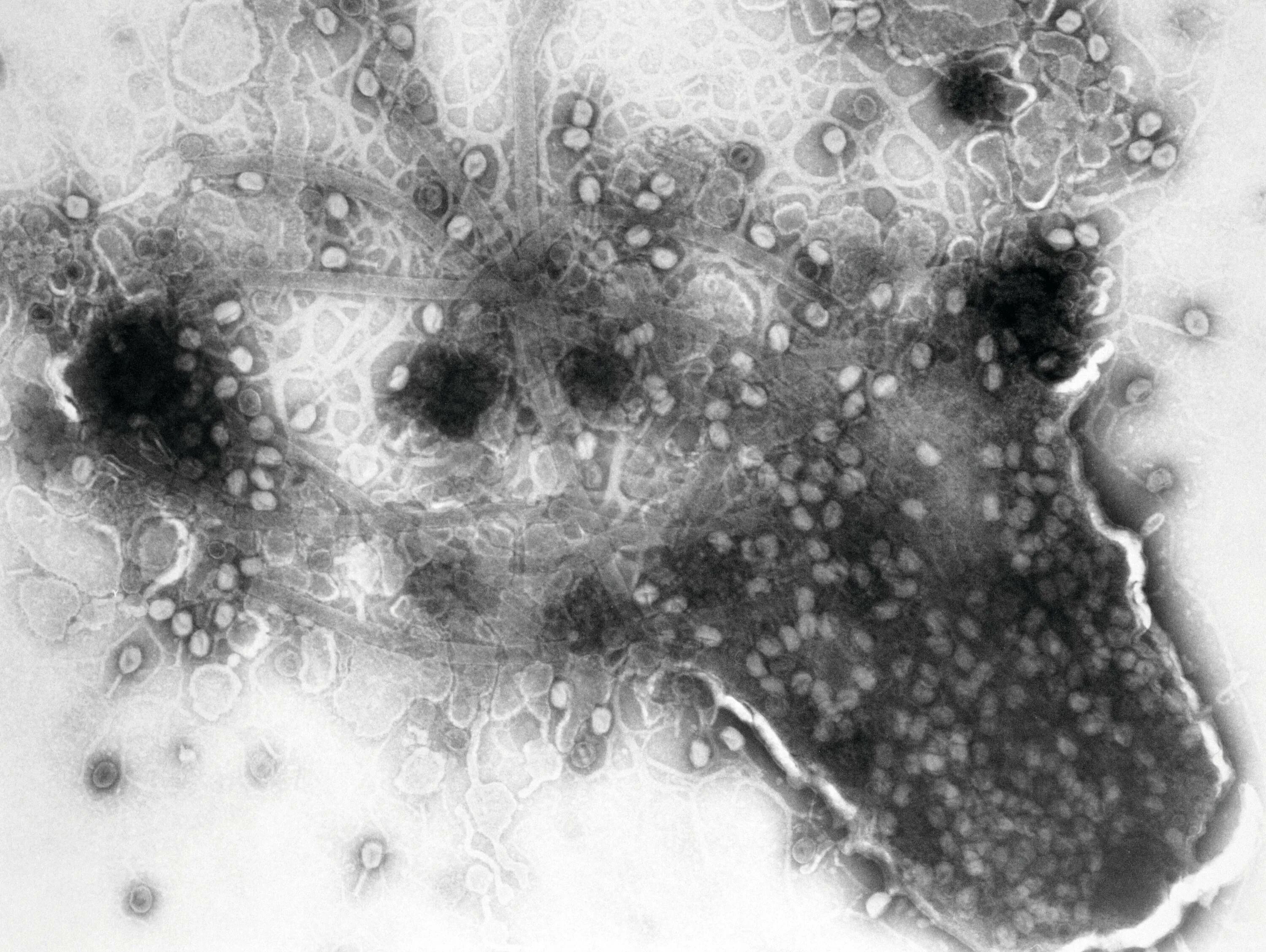 Вещества разрушающие клетку. Лизис клетки бактериофагом. Лизиса бактериальных клеток. Лизис бактериофага бактерий. Фаг т4 под микроскопом.