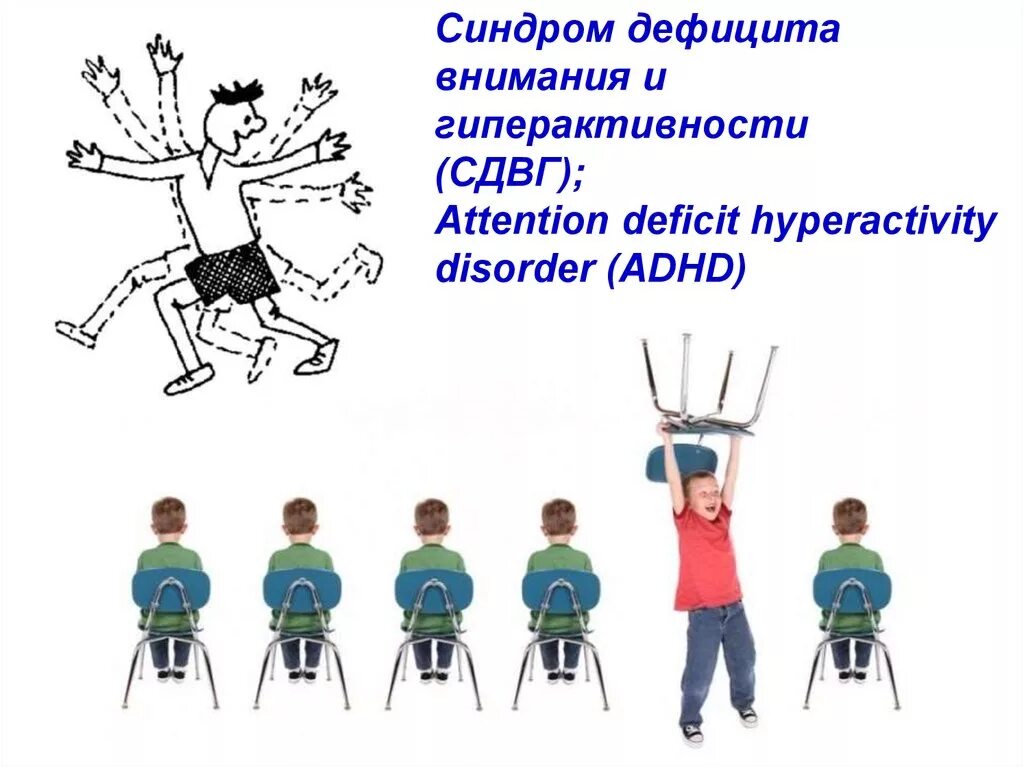Синдром дефицита внимания и гиперактивности (СДВГ). Дети с синдромом дефицита внимания и гиперактивностью. Синдрому дефицита внимания (СДВГ. Синдром дифицитавнимания.