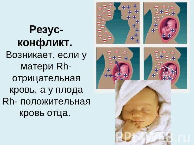 Родить с отрицательным резусом. У матери кровь резус- отрицательная у плода положительная. Резус конфликт мать положительная отец отрицательный. У мамы резус отрицательный у плода положительный. Резус отрицательная мать и резус положительный плод.