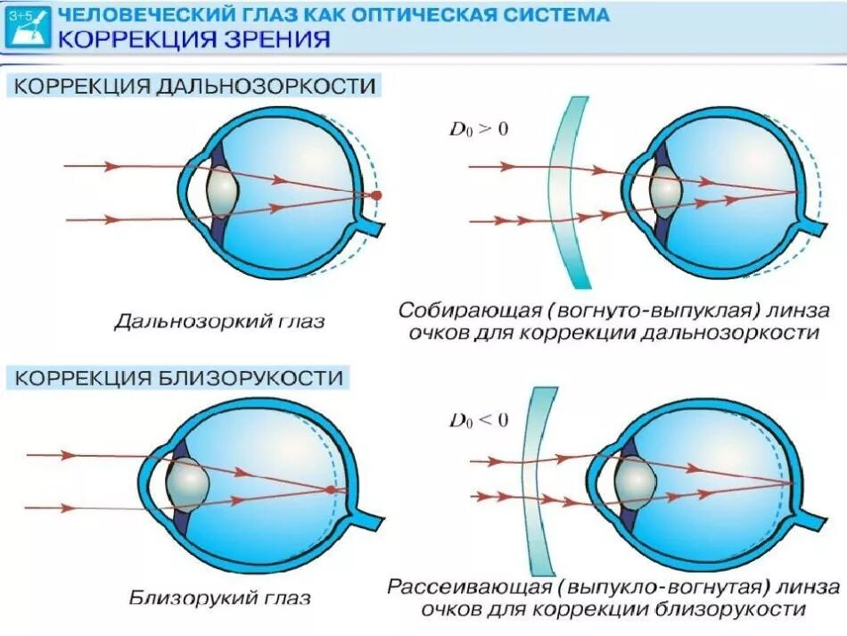 Точка зрения баллы. Дефекты зрения близорукость и дальнозоркость. Зрение человека дальнозоркость и близорукость. Строение глаза близорукость и дальнозоркость. Исправление дальнозоркости линза.